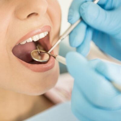 Tips To Making A Choice On The Best Dental Care Services In Essex